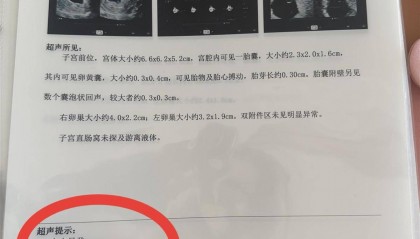 辽宁一孕妇两个月内从一胎变四胞胎，每次产检发现多出一胎，医生：系同卵四胞胎，概率1300万至1500万分之一