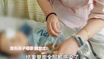 江西一5岁男孩在幼儿园被戳伤致左眼失明,家长称老师用猪油涂抹试图消肿