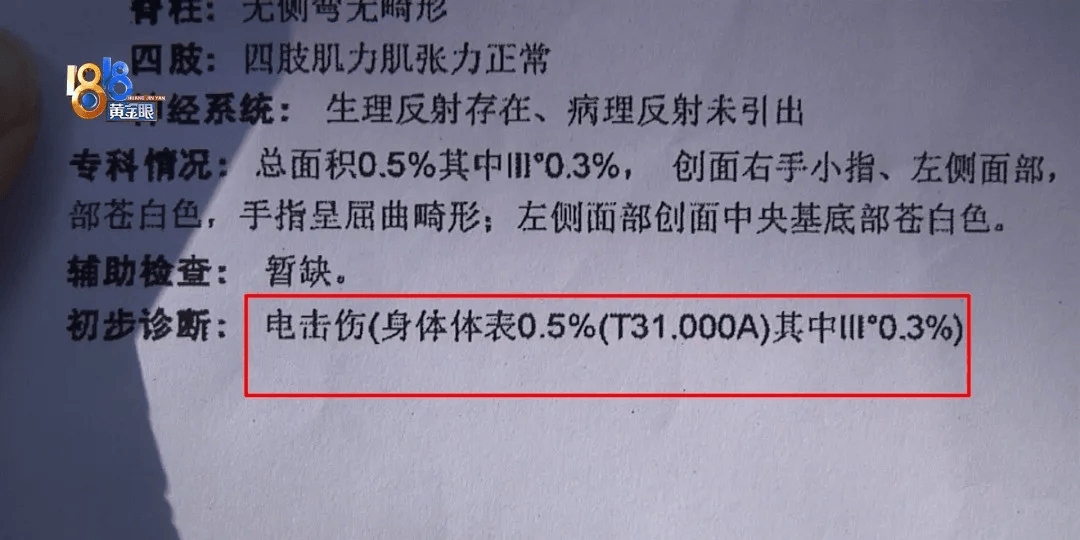 5岁男童瞬间晕厥，筋都断了！街上常见，看见立即远离