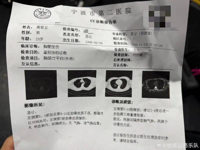 突发!知名音乐人摔下舞台,断了6根肋骨!